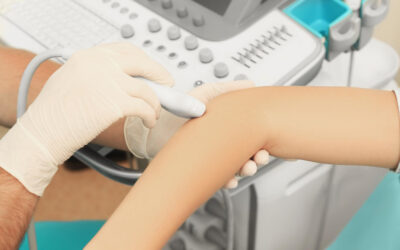 Ecografía para identificar el lipedema en los brazos: ¿cómo puede ayudar?